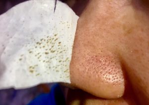 日本 藥妝 推薦 肌純 碳酸泡泡 碳酸面膜 粉刺神器 黑頭 毛孔 痘痘肌 保濕 溫和 深清毛孔 拔粉刺