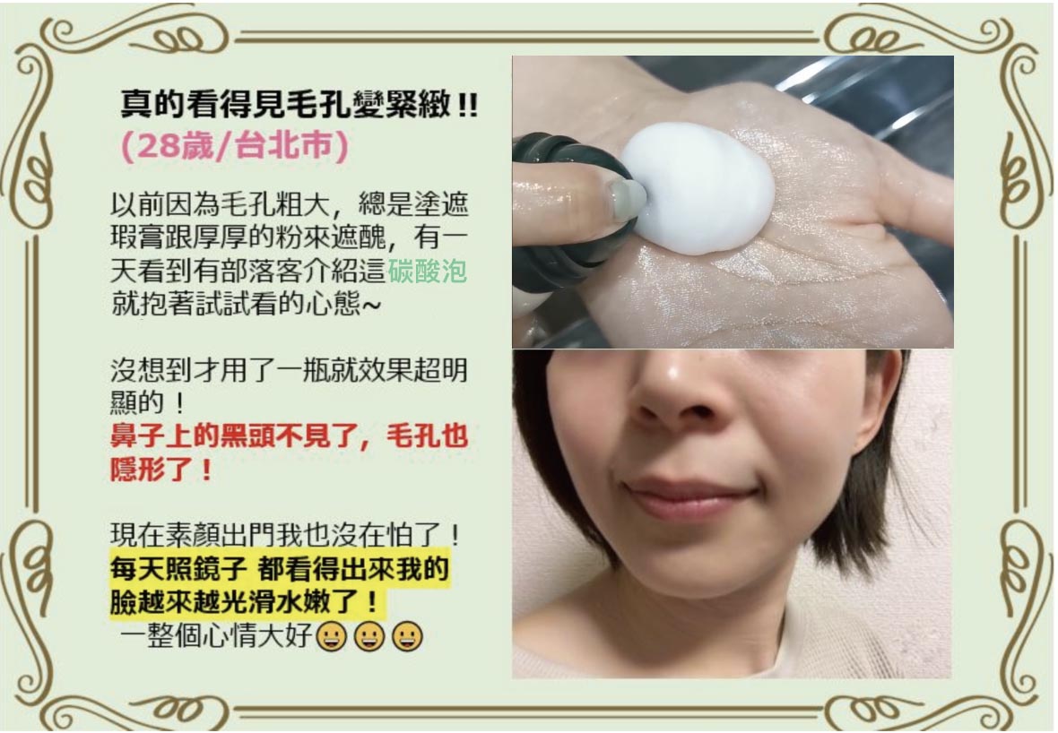 日本 藥妝 推薦 肌純 碳酸泡泡 碳酸面膜 粉刺神器 黑頭 毛孔 痘痘肌 保濕 溫和 深清毛孔 拔粉刺