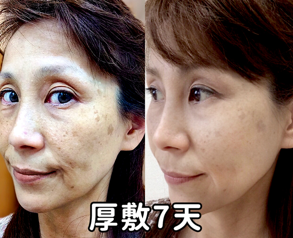 日本 藥妝 推薦 肌純 碳酸泡泡 碳酸面膜 粉刺神器 黑頭 毛孔 痘痘肌 保濕 溫和 深清毛孔 拔粉刺